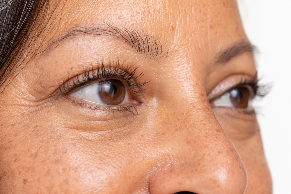 Botox Myths and Facts Everyone Should Know